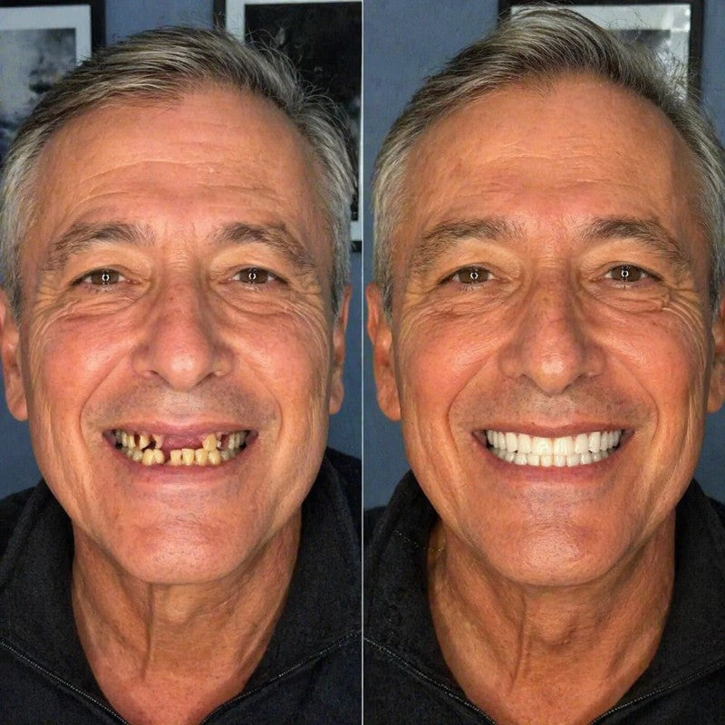 SmileNow 😁 - 2 en 1